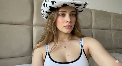 Freckled Charm in Sunlit Cow-Print Hat